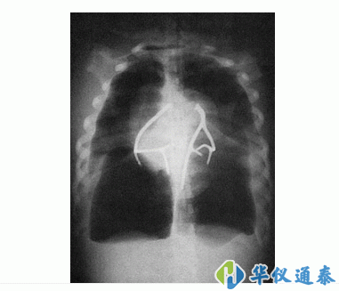 美國CIRS 602三維軀干模體