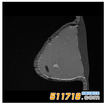 美國CIRS 073多模式乳房活檢和超聲波訓(xùn)練模體3.png