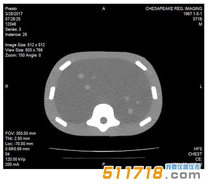 美國CIRS 071B圖像引導(dǎo)腹部活組織檢查模體2.png